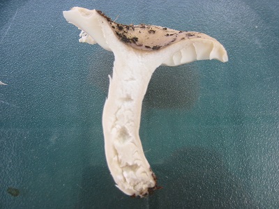 Pied a chair caverneuse