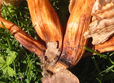 Pied strie en fuseau